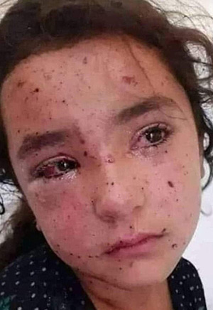 Tuesday's Child Gaza Appeal